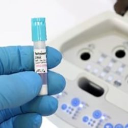 Indicateur biologique ultra rapide pour la stérilisation à la vapeur